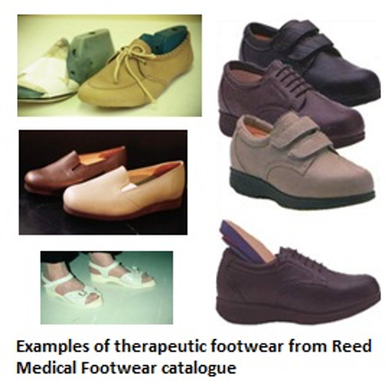 RA and problems with shoes | NRAS