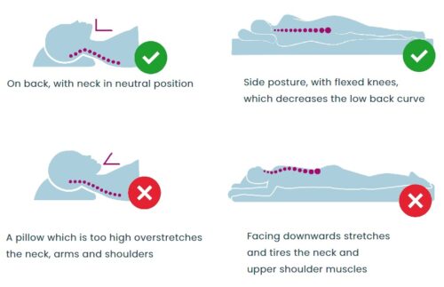 Rheumatoid Arthritis And Sleep 